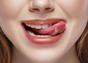 Tren Kekinian Memutihkan Gigi