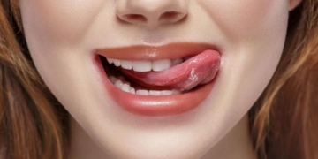 Tren Kekinian Memutihkan Gigi