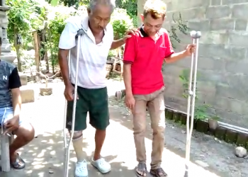 Ada Sampah Plastik, Ada Kepedulian, Terciptalah Kaki Palsu dari Sampah Plastik