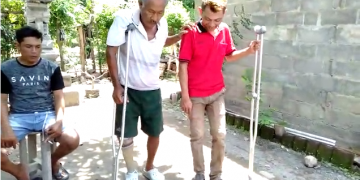 Ada Sampah Plastik, Ada Kepedulian, Terciptalah Kaki Palsu dari Sampah Plastik