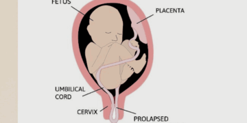 Tali Pusat, Gudangnya Misteri Sekala dan Niskala — Mulai dari Penangkal Ilmu Gaib dan Sumber Sel Punca Secara Medis