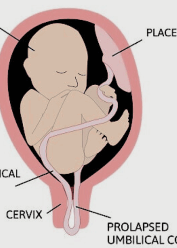 Tali Pusat, Gudangnya Misteri Sekala dan Niskala — Mulai dari Penangkal Ilmu Gaib dan Sumber Sel Punca Secara Medis